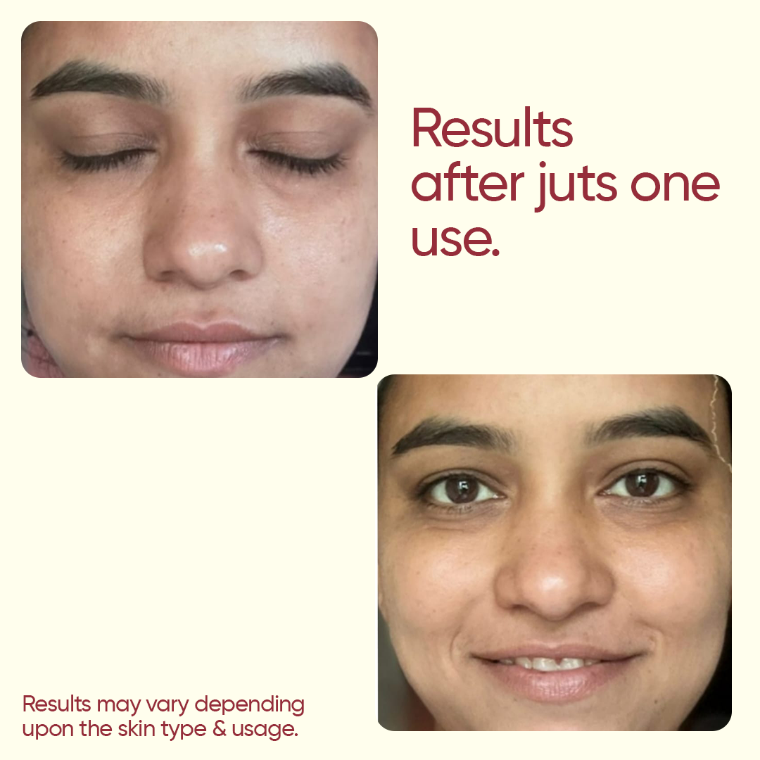 Dermal Radiance Facial Kit