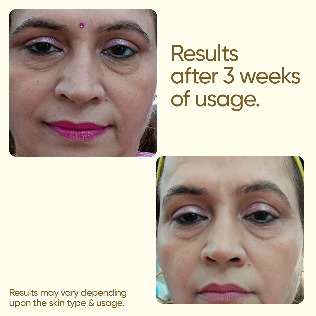 De-Tan | Tan Removal Cream |  6 Pack