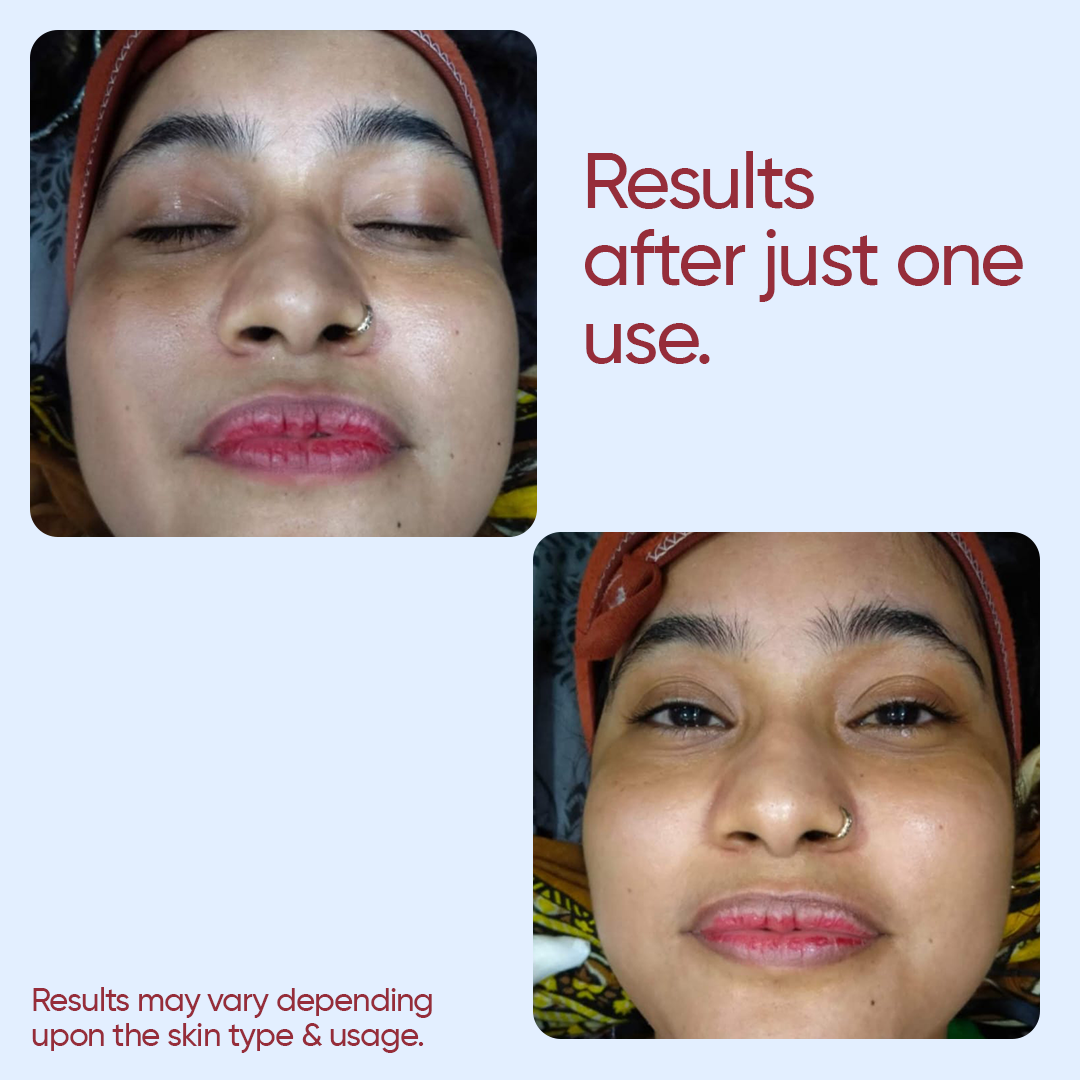 Kumkumadi Facial Kit