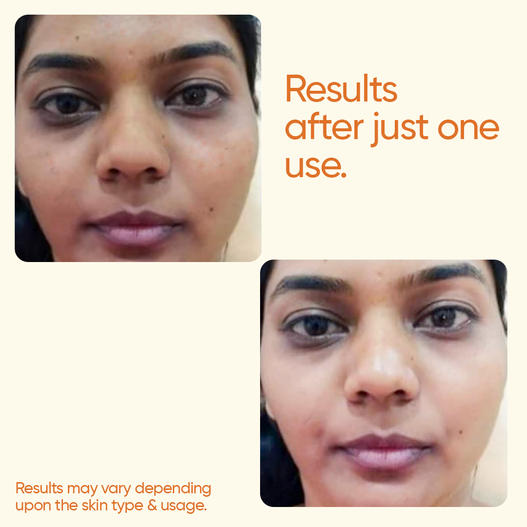 Skin Lightening Facial Kit